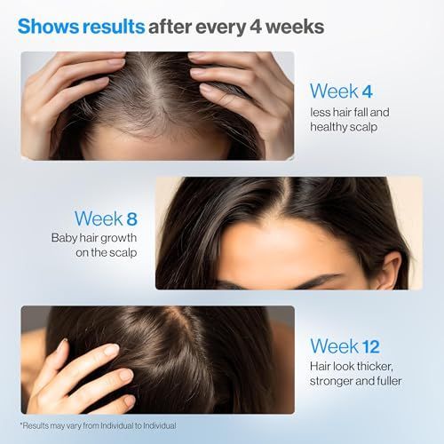 Premium Rosemary Anti-Hair Fal - Hair Care For Hair Fall 评论和价格