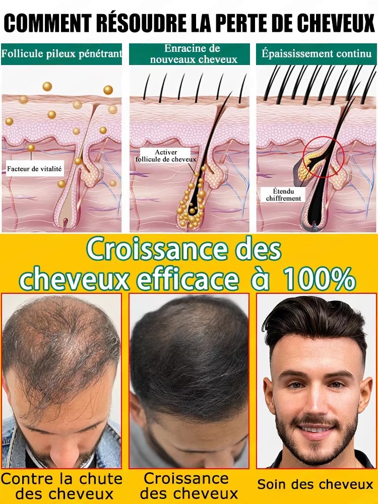 Natural Ginger Hair Care Essen - Hair Care For Hair Fall 评论和价格