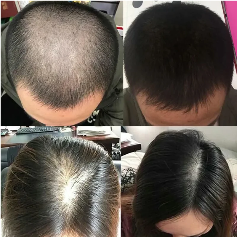 Overlord Plant Hair Growth Liq - Hair Care Or Haircare 评论和价格