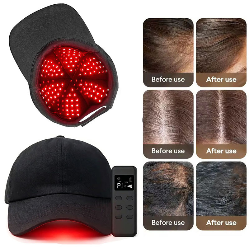 660nm 940nm Light 142 Groups / - Hair Care Wella 评论和价格